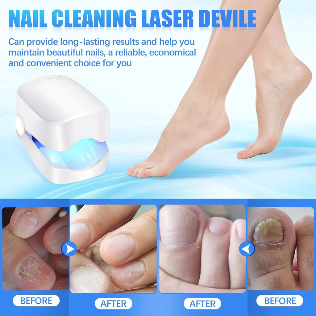 Antifungal Laser Device Wellia