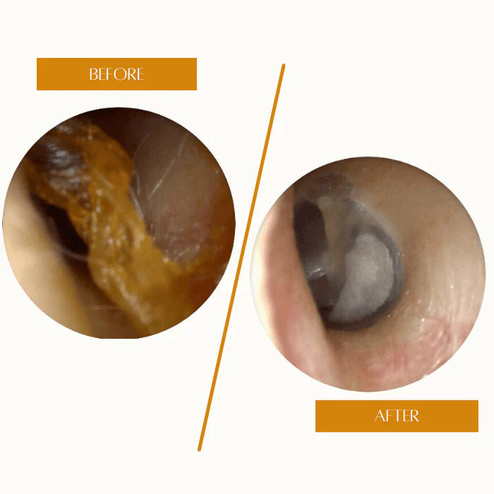 Ear Wax Cleaner Wellia