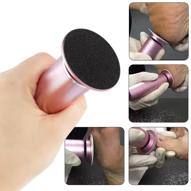 Foot Callus Remover My Store