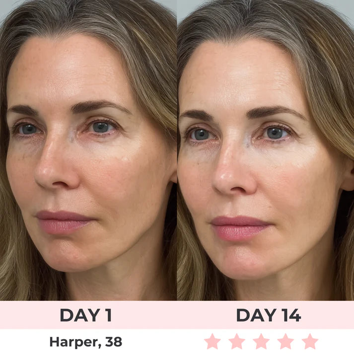 Under-Eye Red Light Therapy Wellia