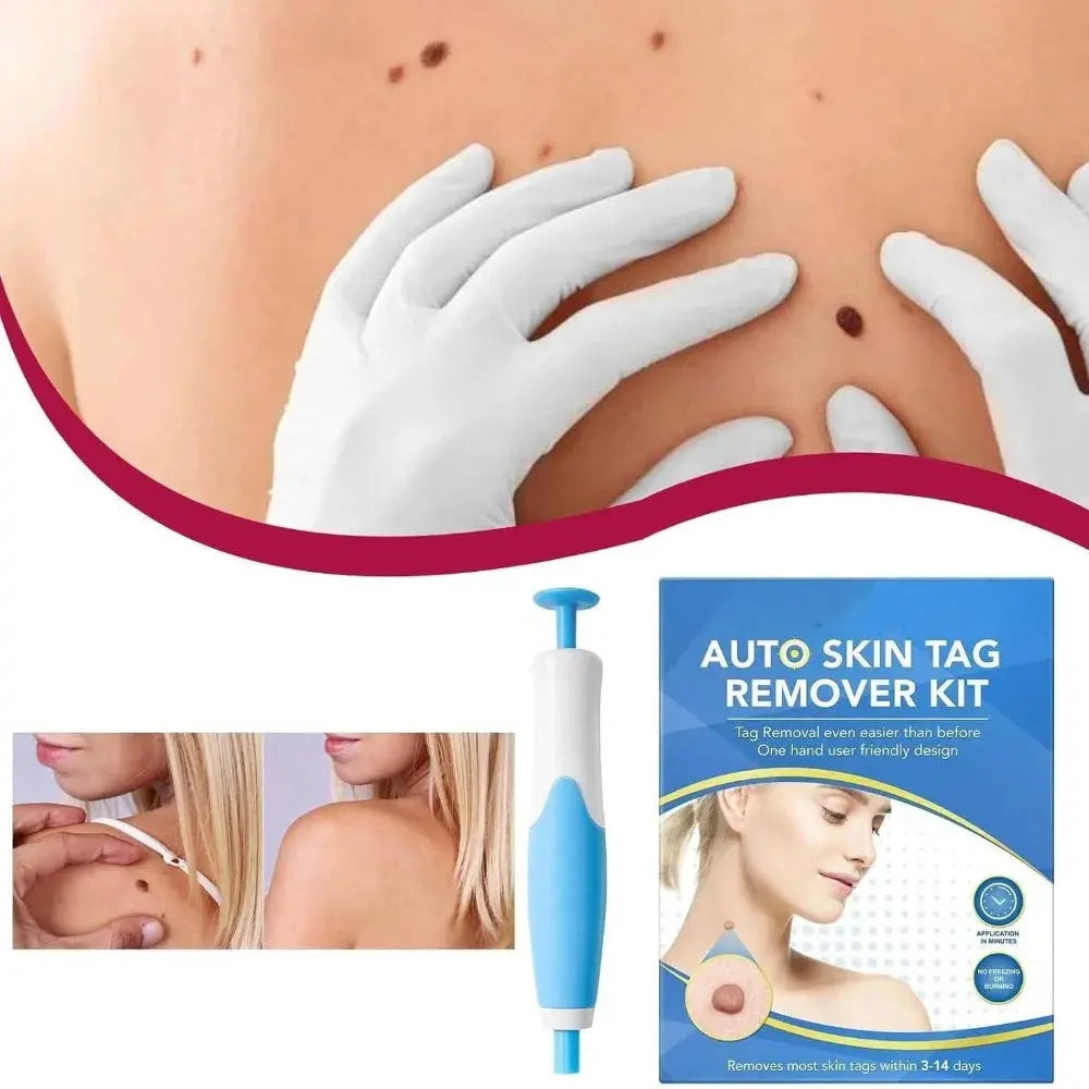 Skin Tag Remover My Store