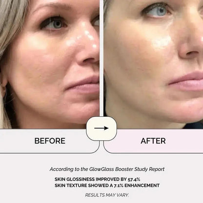 Anti Aging Skin-r Booster Device Wellia