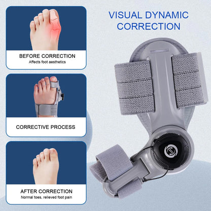 Bunion Corrector Wellia