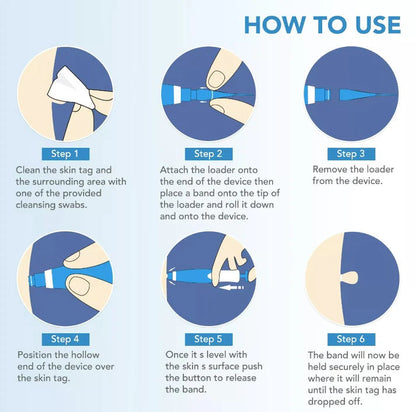 Skin Tag Remover My Store